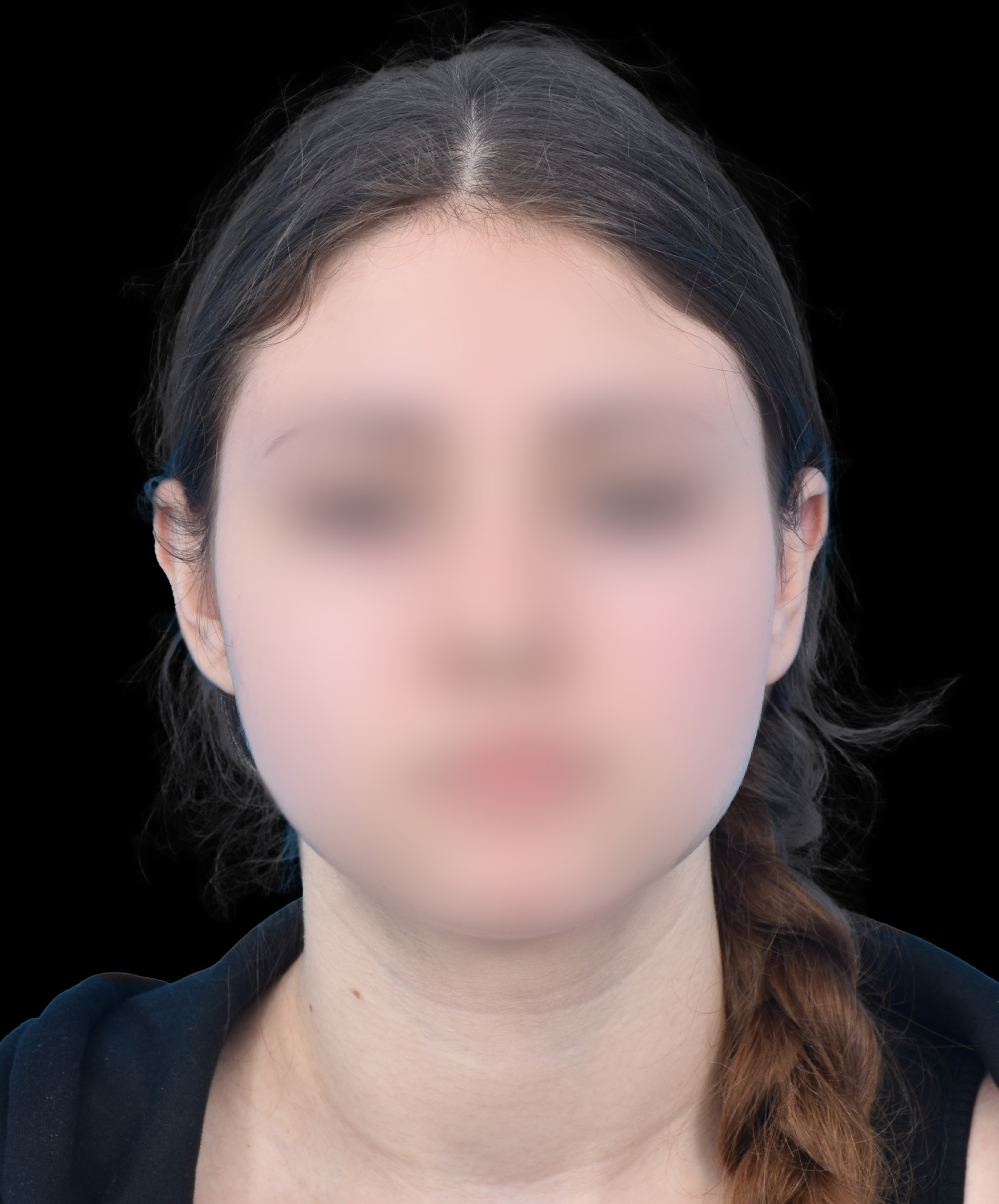 Stan po korekcji odstających uszu Wrocław