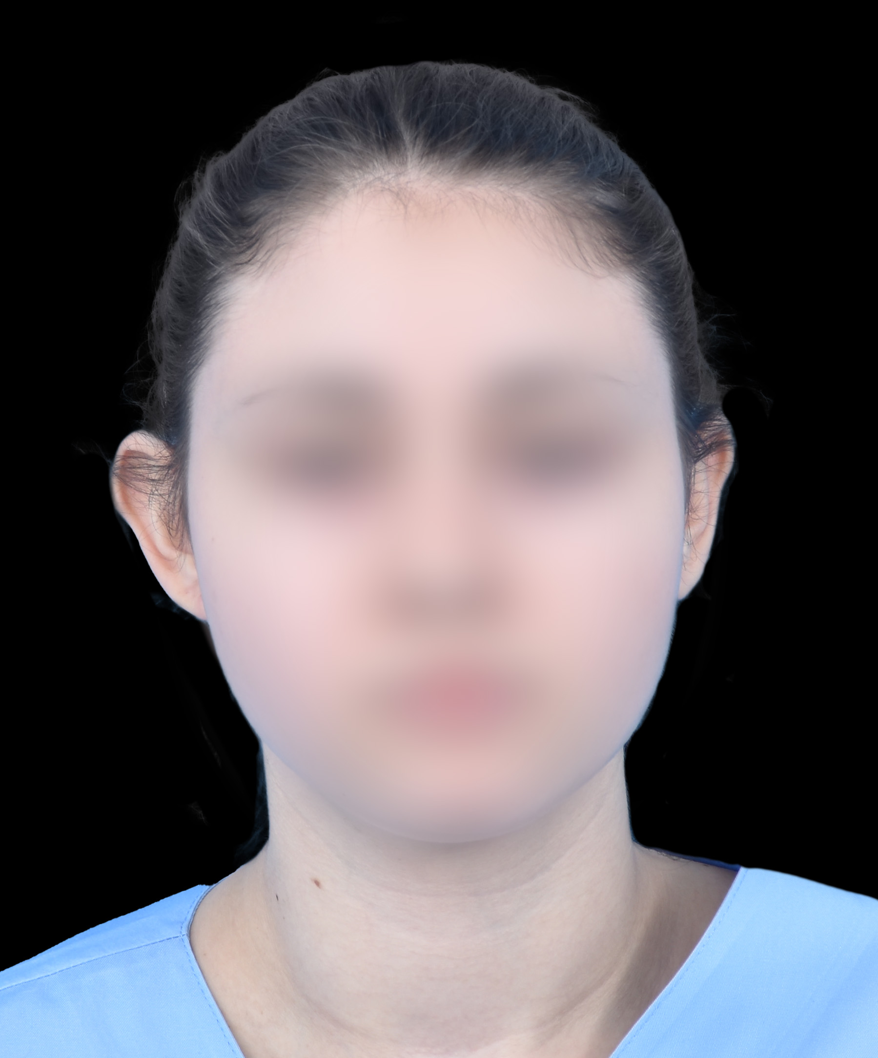 Odstające uszy Wrocław