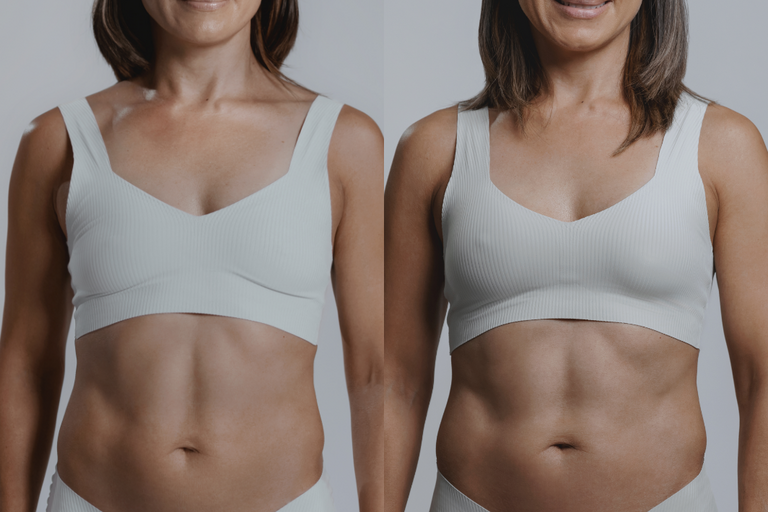 Powiększenie biustu MIA Wrocław