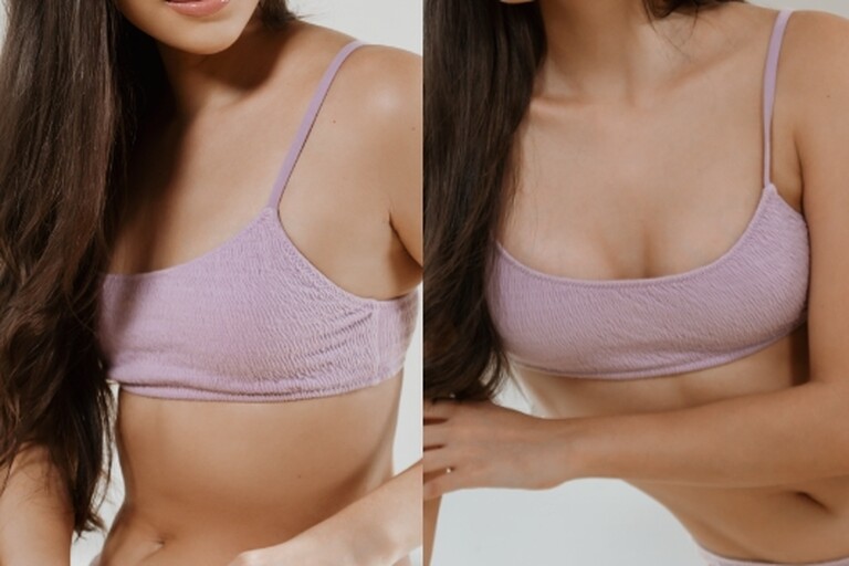 Harmonizacja piersi MIA Wrocław